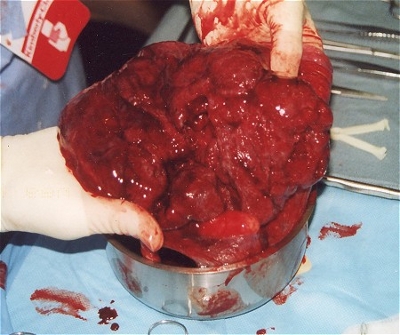 PLACENTA HUMANA.jpg